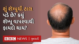 Hair Fall Solution: ખરતા વાળને અટકાવવા શું કરવું જોઈએ?