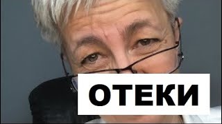 🔴 ОТЕКИ ПРИЧИНА: ВЕНОЗНЫЙ ЗАСТОЙ, ЗАСТОЙ ЛИМФЫ, СНИЖЕНИЕ PH 🔴 ВРАЧ Бублик Н Н WhatsApp 8(950)0330055