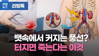 터지면 사망한다?…술·담배 즐긴다면 주의! / 연합뉴스 (Yonhapnews)