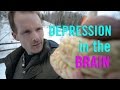 Depression in the Brain: the Biology of Depression