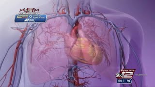 VIDEO: Why heart health is so important for women?