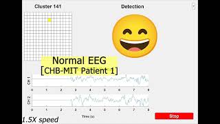 [IEEE ISSCC 2023] SciCNN: A 0-Shot-Retraining Patient-Independent Epilepsy-Tracking SoC