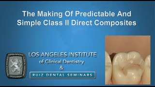 The Making Of Predictable And Simple Class II Direct Composites