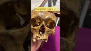 Foramen magnum and it’s defect. #arnoldchiari #malformation | #cranium #skull #nursingstudio #norcet