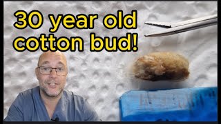 30 YEAR OLD COTTON BUD! 157 #ear #earwax #earwaxremoval #earcleaning #asmr #asmrearwax #satisfying