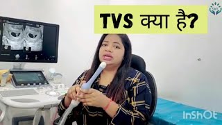 क्या TVS Ultrasound Painful होता है...? | #ultrasoundinpregnancy #sonography