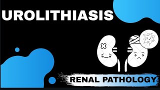 UROLITHIASIS ( Renal pathology)   | Med Bees