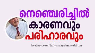 നെഞ്ചെരിച്ചില്‍ കാരണവും പരിഹാരവും -Daily Malayalam Health Tips