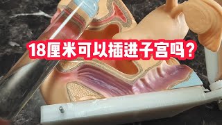 18厘米能顶进子宫吗?