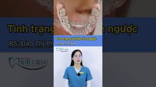 Niềng Răng Móm - Khớp Cắn Ngược| Orthodontic Treatment  for Underbite #shorts