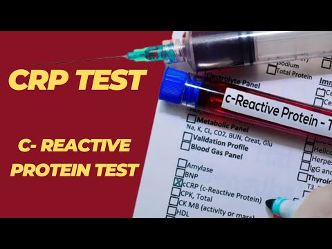 CRP Test Kya Hota Hai | Crp Positive Test | Crp Test Procedure - YouTube