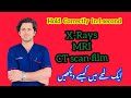 How to Hold X rays CT scan MRI film correctly in 1 second