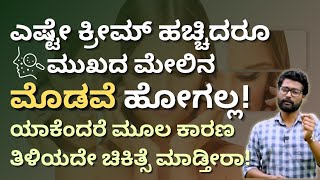 ಯಾವುದೇ ಕ್ರೀಮ್ ಹಚ್ಚಿದರೂ ಮೊಡವೆ ಕಡಿಮೆ ಆಗಲ್ಲ | ಯಾಕೆಂದರೆ ಮೂಲ ಕಾರಣ ತಿಳಿಯದೇ ಚಿಕಿತ್ಸೆ ಮಾಡ್ತೀರಾ | ಆ 2 ಕಾರಣಗಳು