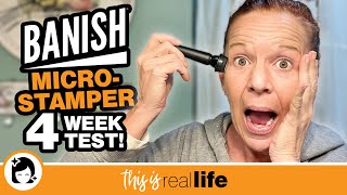 Banish Micro-Stamper: 4 Week Test - THIS IS REAL LIFE