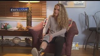 Marathon Bombing Survivor's Foundation To Give Woman New Prosthetic Leg