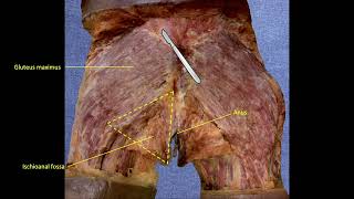 1-Ischioanal Fossa (1/4)