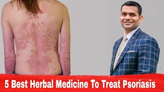 Psoriasis Natural Treatment - 5 Best Herbal Medicine To Treat Psoriasis | Dr. Vivek Joshi