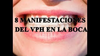 Papiloma cura tiene la el humano en boca