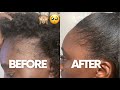 HOW I GREW MY EDGES BACK | HAIR JOURNEY  #EDGES