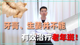 牙膏、生姜是老年斑克星？提醒：真正能淡化老年斑的只有这项治疗