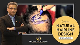 Natural Hairline Design by Dr Satya Saraswat in Hair Transplant