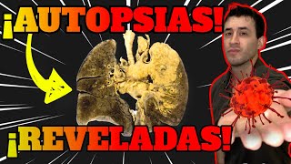 COVID 19|MÁS de 40 AUTOPSIAS REVELADAS | ANÁLISIS POST MORTEM de CAUSAS DE MUERTE