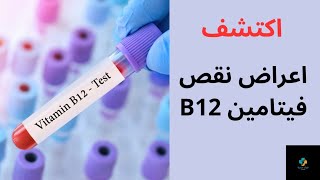 8 اعراض لنقص فيتامين B12 و علامات تحذيرية على أنك في خطر!