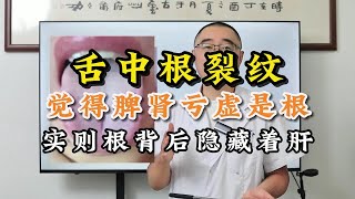 舌中根有明显裂纹，以为脾肾亏虚是根，实则根背后隐藏着肝