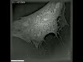 pulmonary arterial smooth muscle cell in action like never seen before