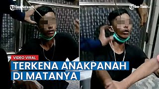 VIRAL Video Wajah Warga di Makassar Terkena Anak Panah, Ini Kata Polisi