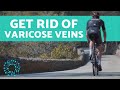 How To GET RID OF VARICOSE VEINS with EXERCISE