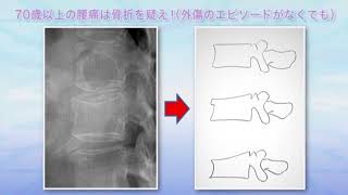 【ダイジェスト版】研修医のための診察手順　第10巻「腰痛の診かた」