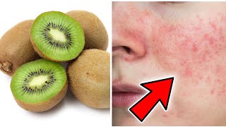 Is Kiwifruit Good for Your Skin? Don't Put Kiwi On your skin Before watching this | Food plus