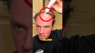 He Was Mocked for Being Bald… Then This Changed Everything 😳#shorts