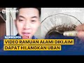 Viral Ramuan Alami Diklaim Dapat Hilangkan Uban, Ini Kata Dokter