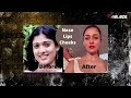 അനുശ്രീ ഇത്ര വെളുത്തതെങ്ങനെ cosmetologist shikha sanghvi anusree transformation