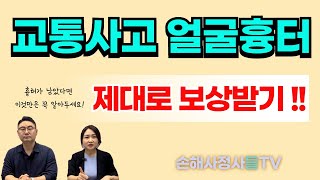 교통사고로 인해 얼굴에 흉터가 남았다면 제대로 보상받으셔야죠! #교통사고얼굴흉터 #교통사고흉터장해 #교통사고추상장해