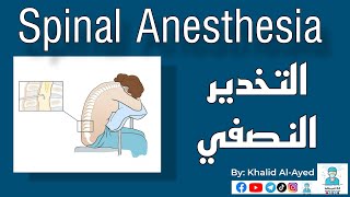 التخدير النصفي Spinal anesthesia | خالد العايد |