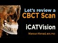 iCATVision Tutorial