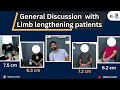 General Discussion  with Limb lengthening patients  limblengtheningsurgery