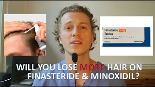 Hair Loss Continues On Finasteride \u0026 Minoxidil!