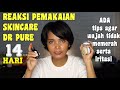 REAKSI PEMAKAIAN SKINCARE CREAM DR PURE SELAMA DUA MINGGU & TIPS AGAR WAJAH TIDAK MEMERAH & IRITASI