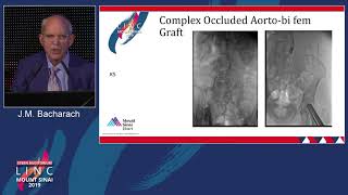 Stern D1 - Access Decisions: My Logic to Where, When, Why and How? - Dr. Bacharach