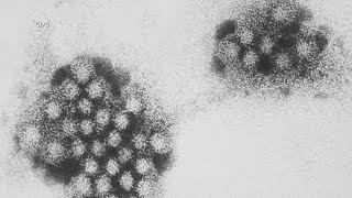 Bexar County doctors weigh in on Norovirus outbreak affecting states across the country