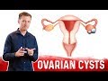 Ovarian Cysts: Causes, Symptoms & Natural Treatment – Dr.Berg