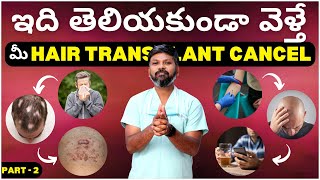 #AskDrJohnWatts | ఇది తెలియకుండా వెళ్తే మీ HAIR TRANSPLANT CANCEL PART - 2 |Hair Specialist Explains