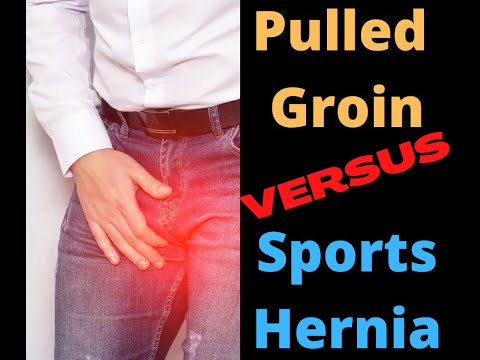Pulled groin versus sports hernia | Total Performance Physical Therapy | 215.997.9898 Pulled groin versus sports hernia | Total Performance Physical Therapy | 215.997.9898