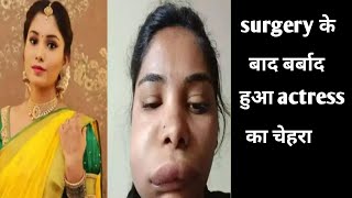 Actress face ruined after surgery|Bollywood news today| Bolly tale