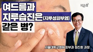 여드름과 지루습진(지루성피부염)은 헷갈리면 안됩니다 [정진호의 피부쏙쏙 4화]  - 서울대학교병원 피부과 정진호 과장