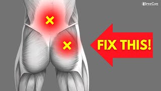 How to Fix Lower Back and Hip Pain FOR GOOD